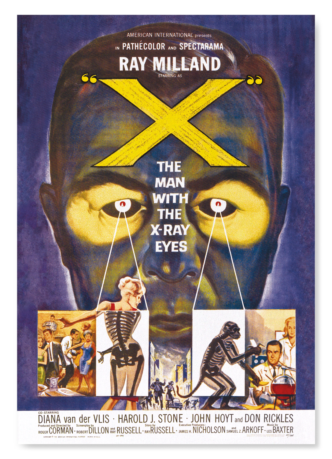X, THE MAN WITH THE X-RAY EYES (1963)